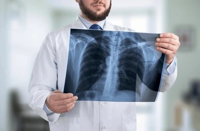 Chest X-ray Example